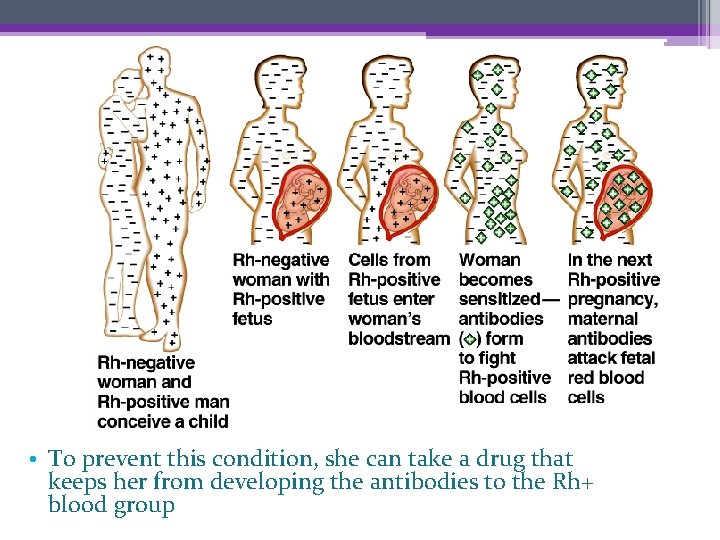  • To prevent this condition, she can take a drug that keeps her