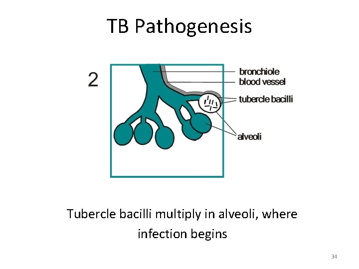 TB Pathogenesis Tubercle bacilli multiply in alveoli, where infection begins 34 