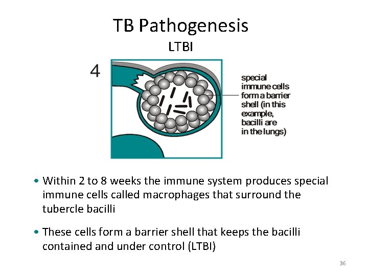 TB Pathogenesis LTBI • Within 2 to 8 weeks the immune system produces special