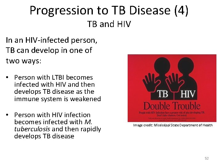 Progression to TB Disease (4) TB and HIV In an HIV-infected person, TB can