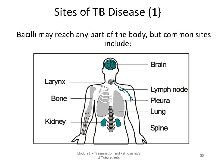 Sites of TB Disease (1) Bacilli may reach any part of the body, but