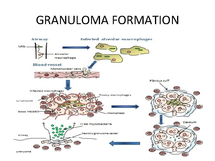 GRANULOMA FORMATION 