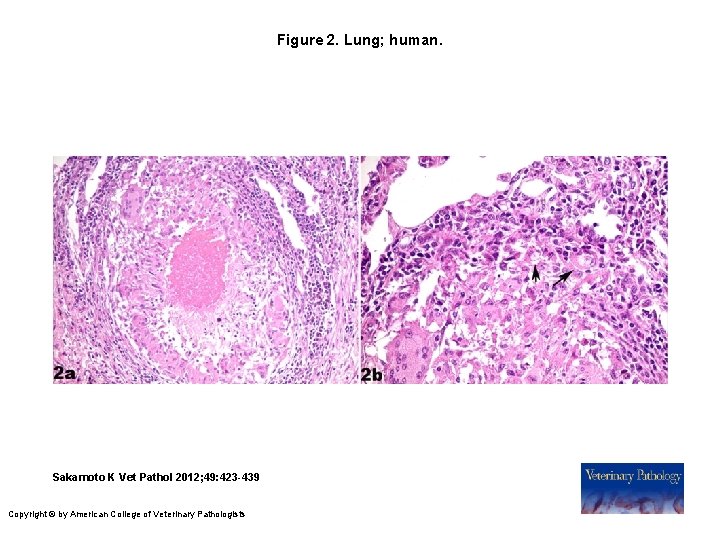 Figure 2. Lung; human. Sakamoto K Vet Pathol 2012; 49: 423 -439 Copyright ©