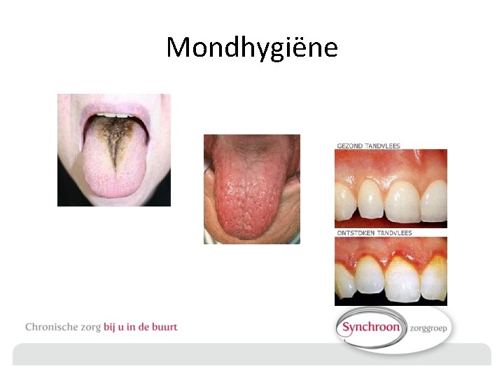 Mondhygiëne 