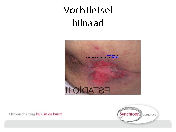 Deze foto van Onbekende auteur is gelicentieerd onder CC BY-NC Vochtletsel bilnaad 