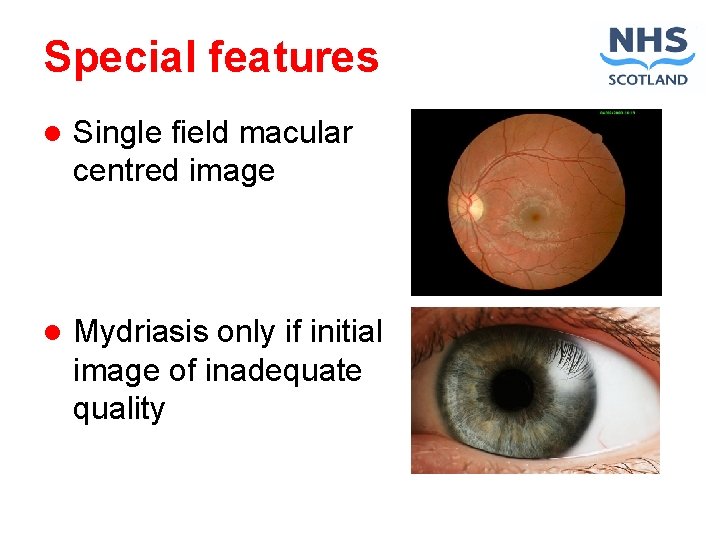 Special features l Single field macular centred image l Mydriasis only if initial image