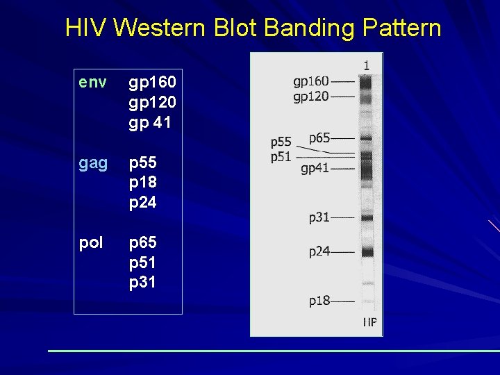 HIV Western Blot Banding Pattern env gp 160 gp 120 gp 41 gag p