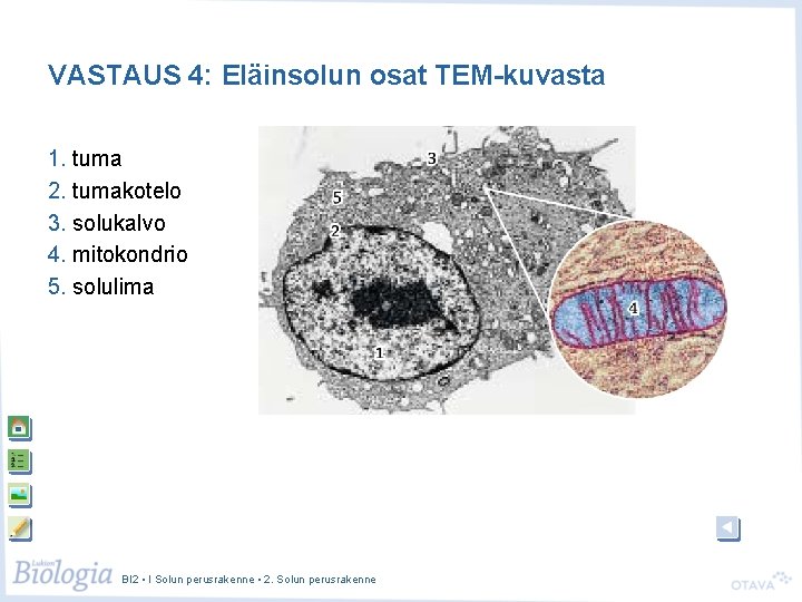 VASTAUS 4: Eläinsolun osat TEM-kuvasta 1. tuma 2. tumakotelo 3. solukalvo 4. mitokondrio 5.