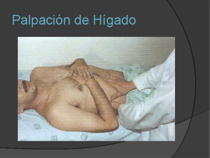 Palpación de Hígado 