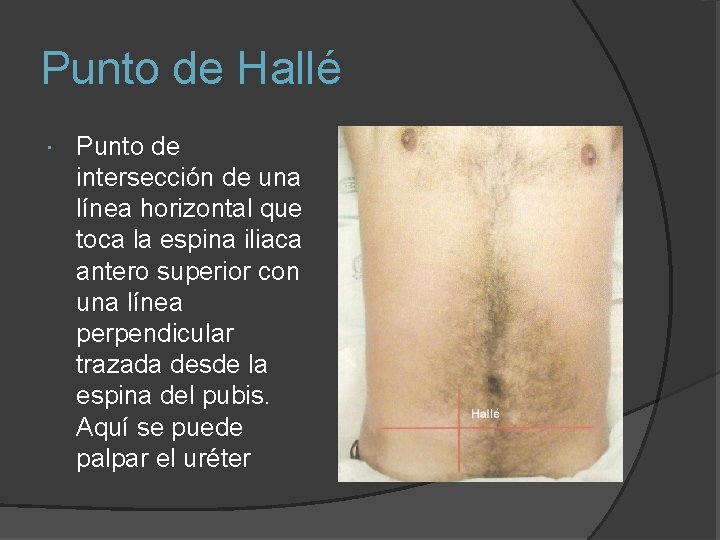 Punto de Hallé Punto de intersección de una línea horizontal que toca la espina
