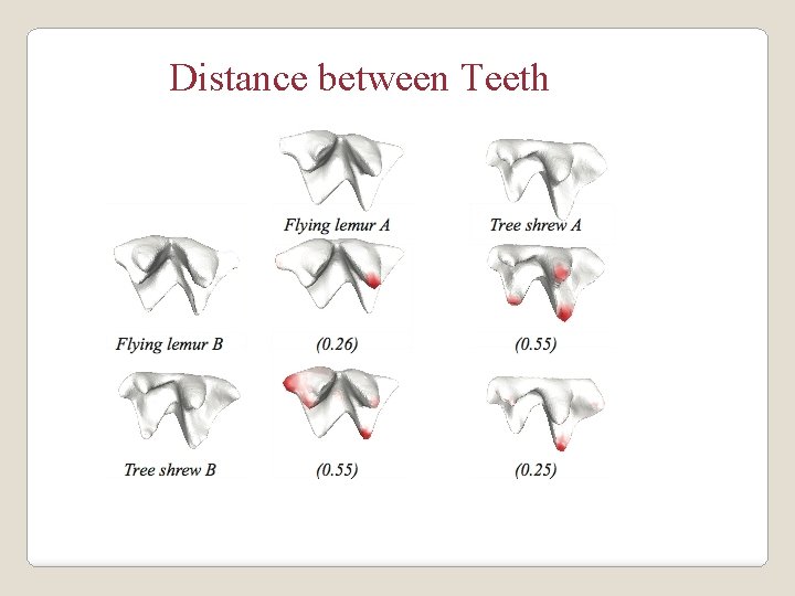 Distance between Teeth 