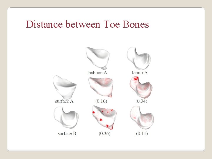 Distance between Toe Bones 