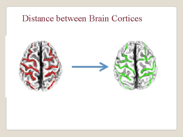 Distance between Brain Cortices 