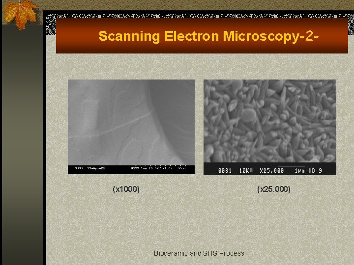 Scanning Electron Microscopy-2 - (x 1000) (x 25. 000) Bioceramic and SHS Process 