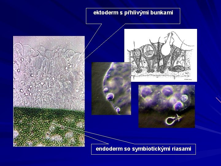 ektoderm s pŕhlivými bunkami endoderm so symbiotickými riasami 