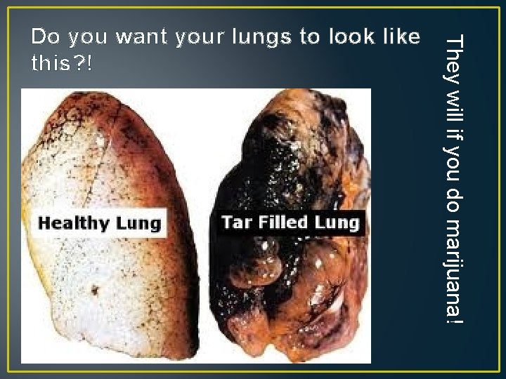 They will if you do marijuana! Do you want your lungs to look like