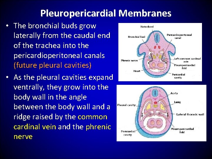 Pleuropericardial Membranes • The bronchial buds grow laterally from the caudal end of the