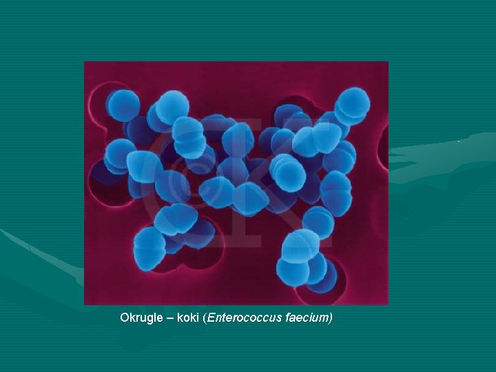 Okrugle – koki (Enterococcus faecium) 