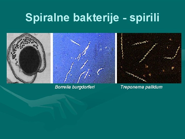 Spiralne bakterije - spirili Borrelia burgdorferi Treponema pallidum 