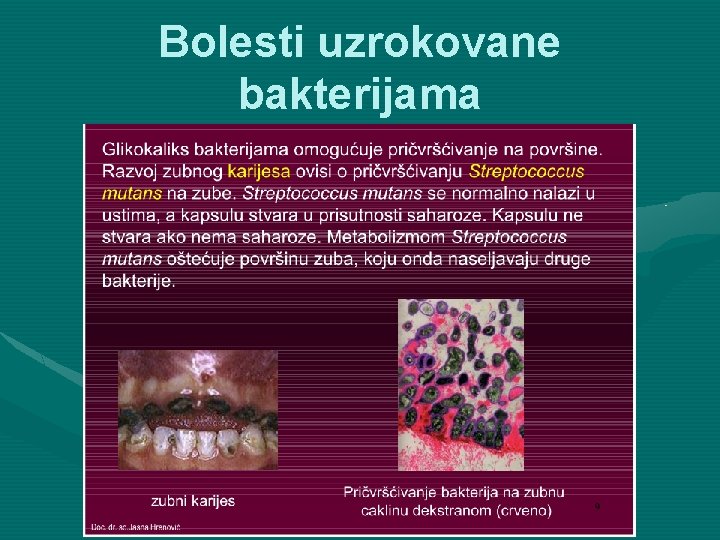 Bolesti uzrokovane bakterijama 