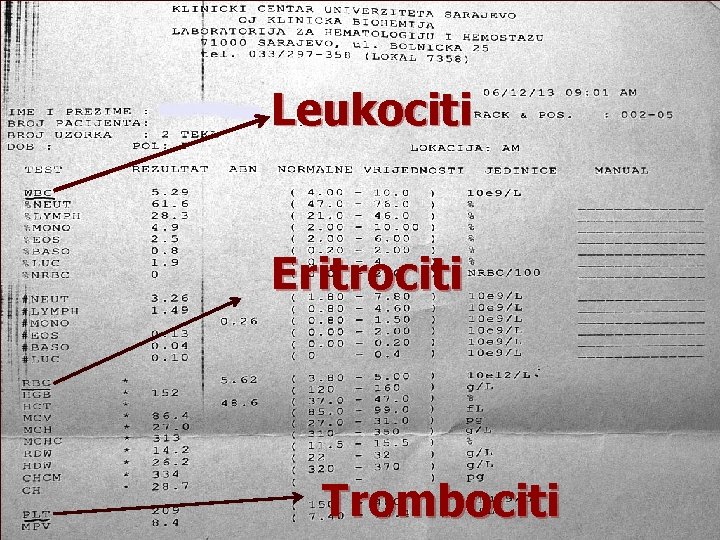 Leukociti Eritrociti Trombociti 