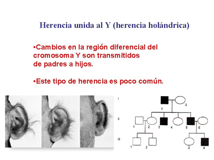 Herencia unida al Y (herencia holándrica) • Cambios en la región diferencial del cromosoma
