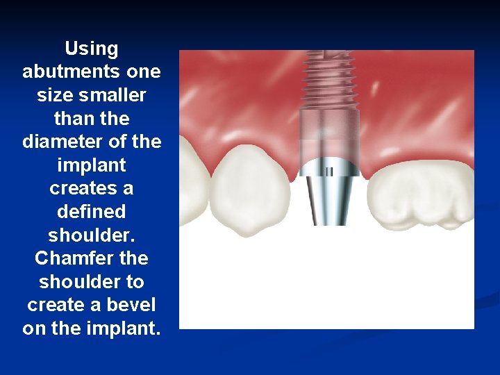 Using abutments one size smaller than the diameter of the implant creates a defined