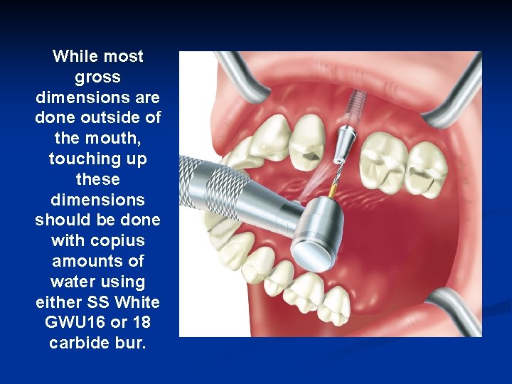 While most gross dimensions are done outside of the mouth, touching up these dimensions