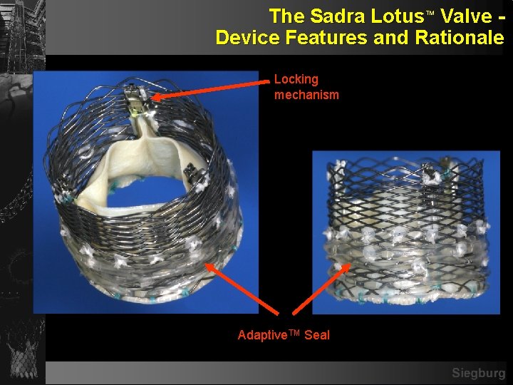 The Sadra Lotus Valve - Device Features and Rationale TM Locking mechanism Adaptive. TM