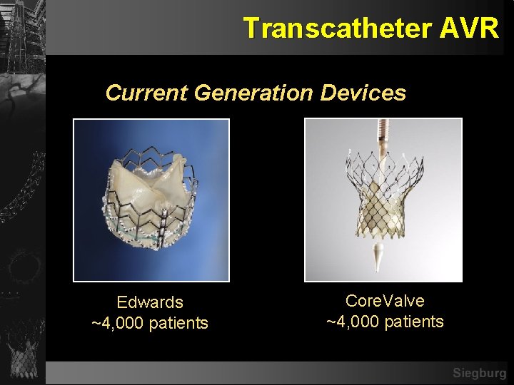 Transcatheter AVR Current Generation Devices Edwards ~4, 000 patients Core. Valve ~4, 000 patients