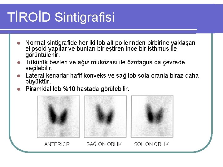 TİROİD Sintigrafisi Normal sintigrafide her iki lob alt pollerinden birbirine yaklaşan elipsoid yapılar ve