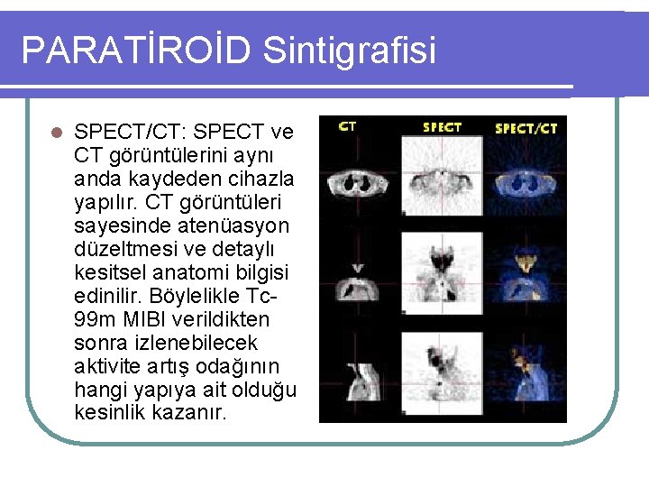 PARATİROİD Sintigrafisi l SPECT/CT: SPECT ve CT görüntülerini aynı anda kaydeden cihazla yapılır. CT