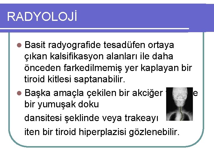 RADYOLOJİ l Basit radyografide tesadüfen ortaya çıkan kalsifikasyon alanları ile daha önceden farkedilmemiş yer