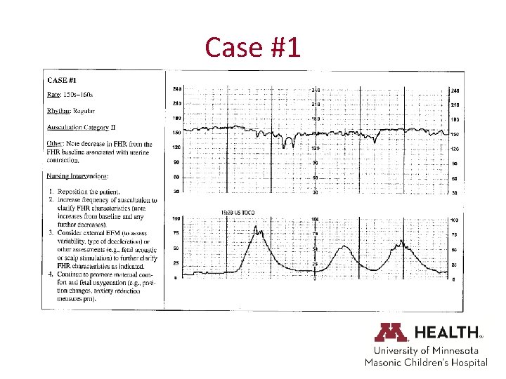 Case #1 