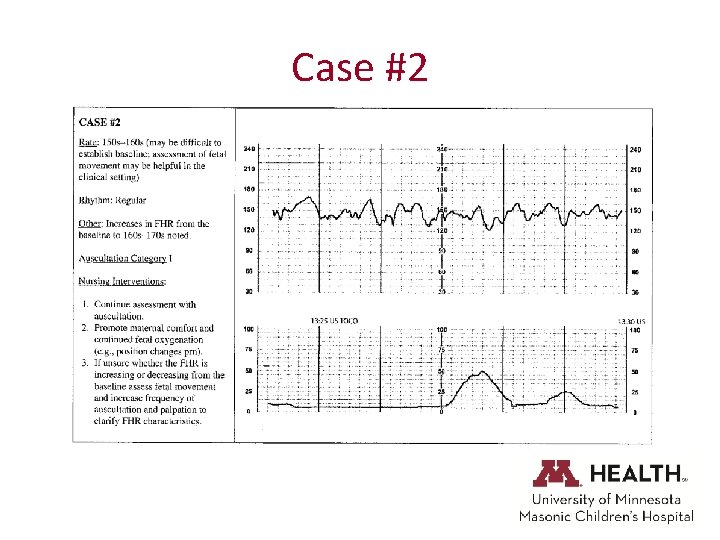 Case #2 