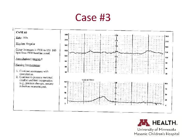 Case #3 