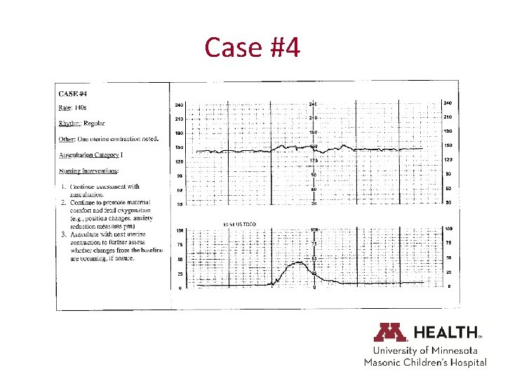 Case #4 