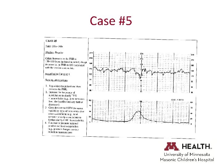 Case #5 