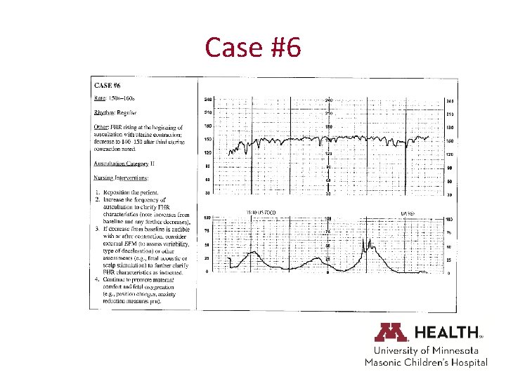 Case #6 