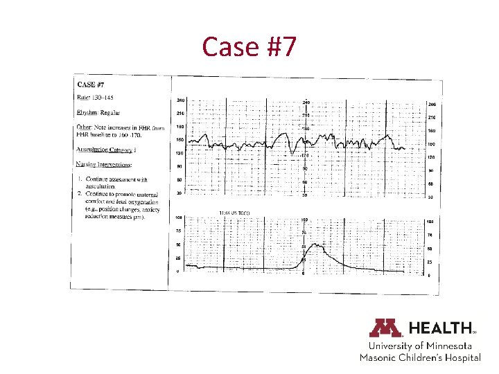 Case #7 