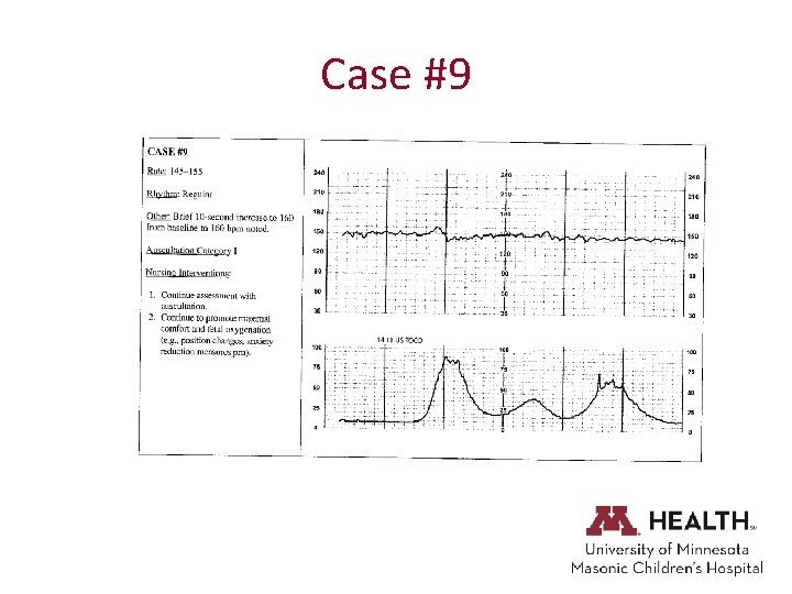 Case #9 