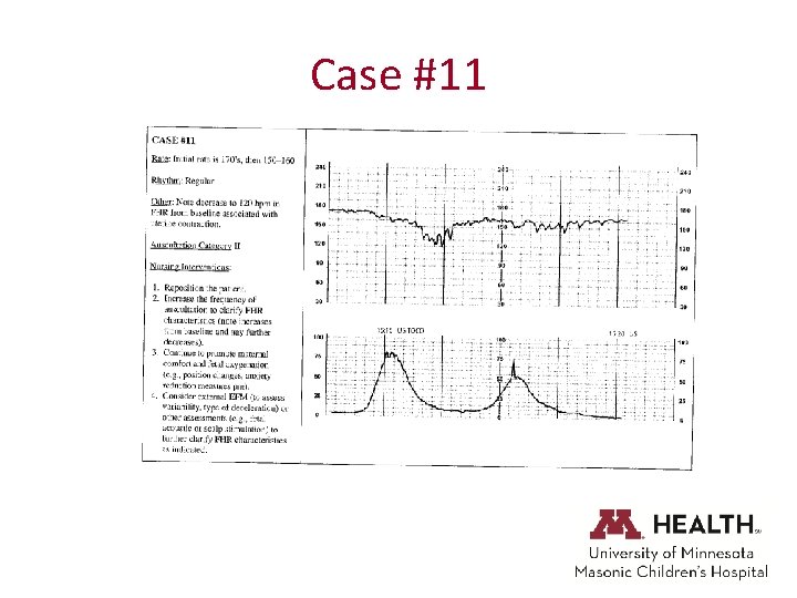 Case #11 