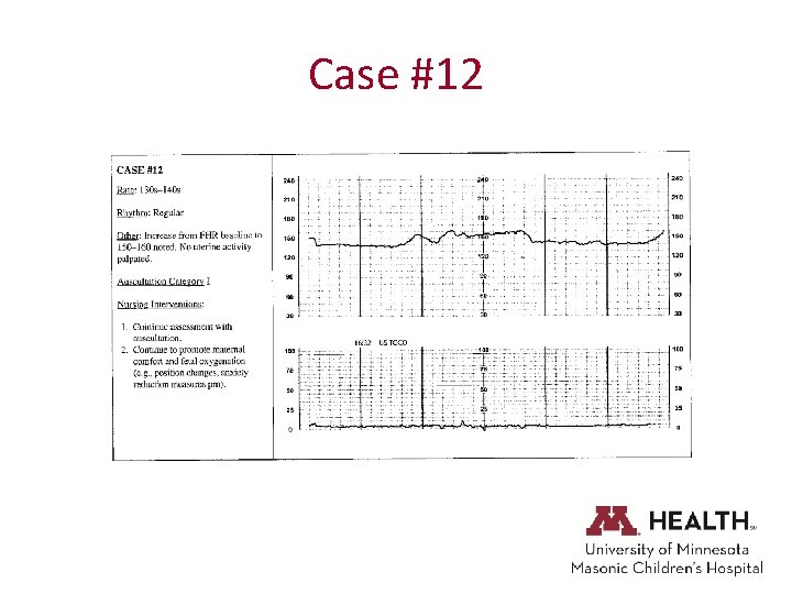 Case #12 
