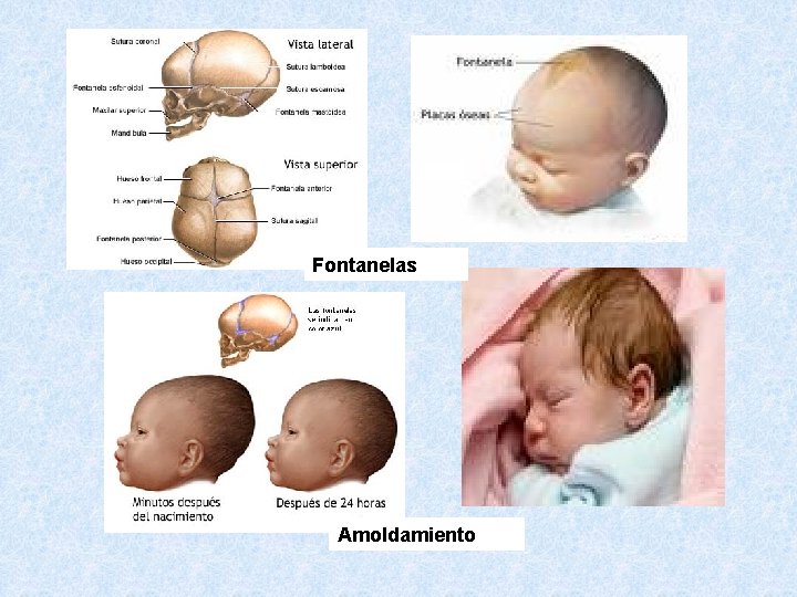 Fontanelas Amoldamiento 