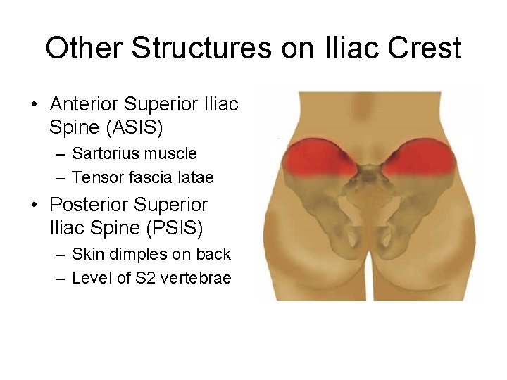 Other Structures on Iliac Crest • Anterior Superior Iliac Spine (ASIS) – Sartorius muscle