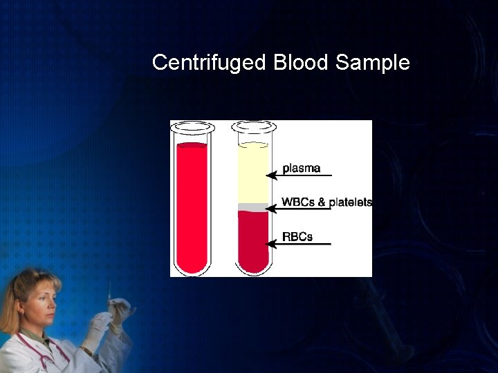 Centrifuged Blood Sample 