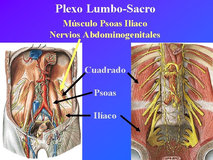 Plexo Lumbo-Sacro Músculo Psoas Iliaco Nervios Abdominogenitales Cuadrado Psoas Ilíaco 