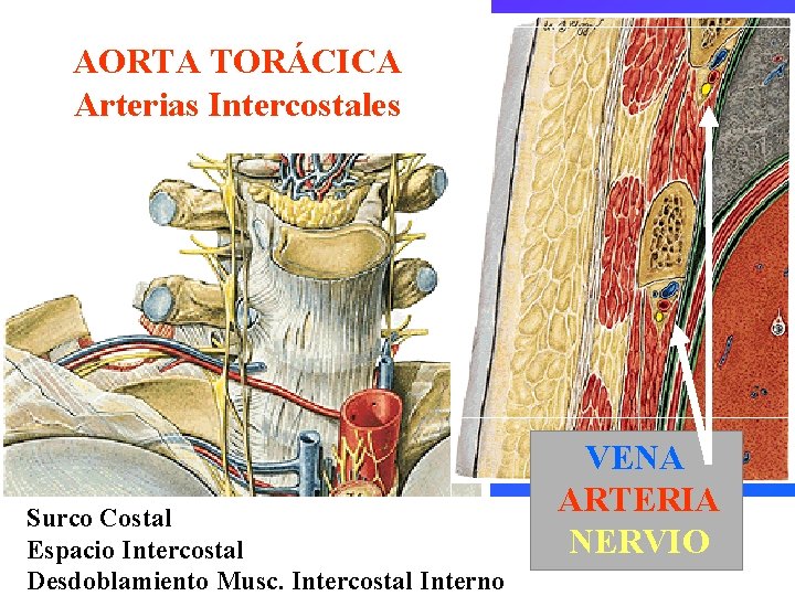 AORTA TORÁCICA Arterias Intercostales Surco Costal Espacio Intercostal Desdoblamiento Musc. Intercostal Interno VENA ARTERIA