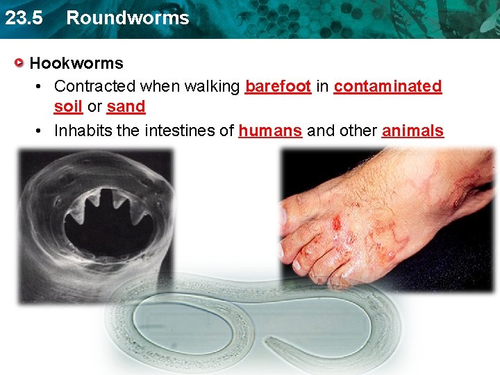 23. 5 Roundworms Hookworms • Contracted when walking barefoot in contaminated soil or sand