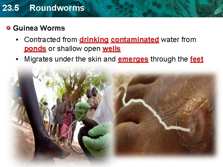 23. 5 Roundworms Guinea Worms • Contracted from drinking contaminated water from ponds or